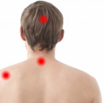 FOCI dell'osteocondrosi